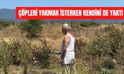 Çöpleri yakmak isterken kendini de yaktı