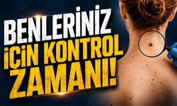 Bolu’da Euromelanom Haftasına Özel Muayene Uygulaması