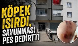 Bolu’da Belçika kurdu çocuğu kalçasından ısırdı, sahibinin sözleri pes dedirtti