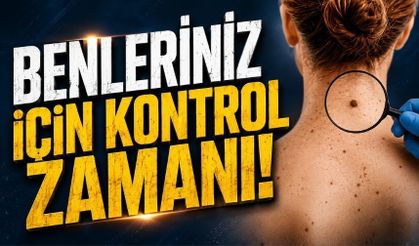 Bolu’da Euromelanom Haftasına Özel Muayene Uygulaması