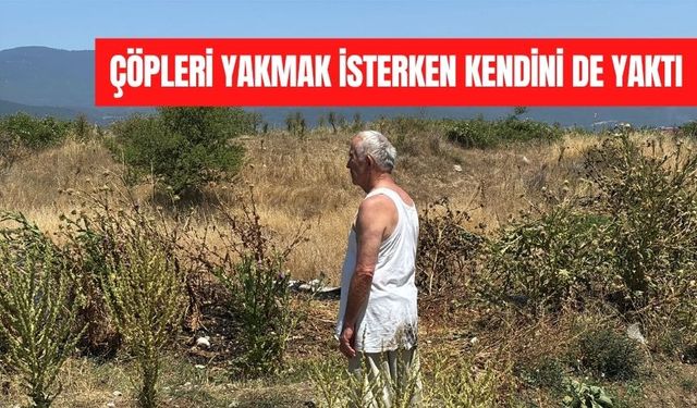 Çöpleri yakmak isterken kendini de yaktı