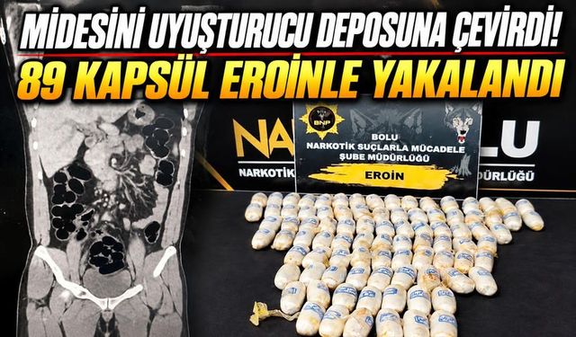Zehir Dolu Yolculuk Bolu’da Bitti! Midesinden 89 Kapsül Çıktı